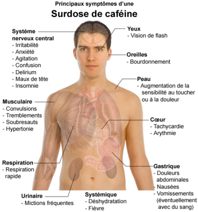 400px-Principaux_symptômes_d'une_surdose_de_caféine